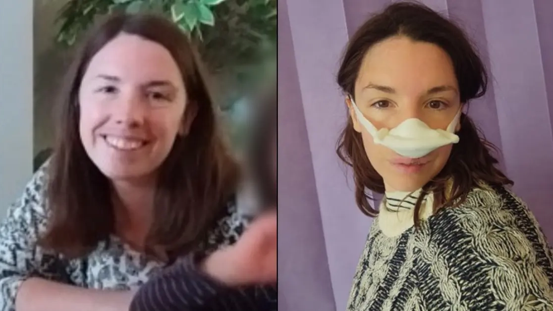 Woman who thought blocked nose was just ‘seasonal cold’ left stunned after finding out devastating diagnosis