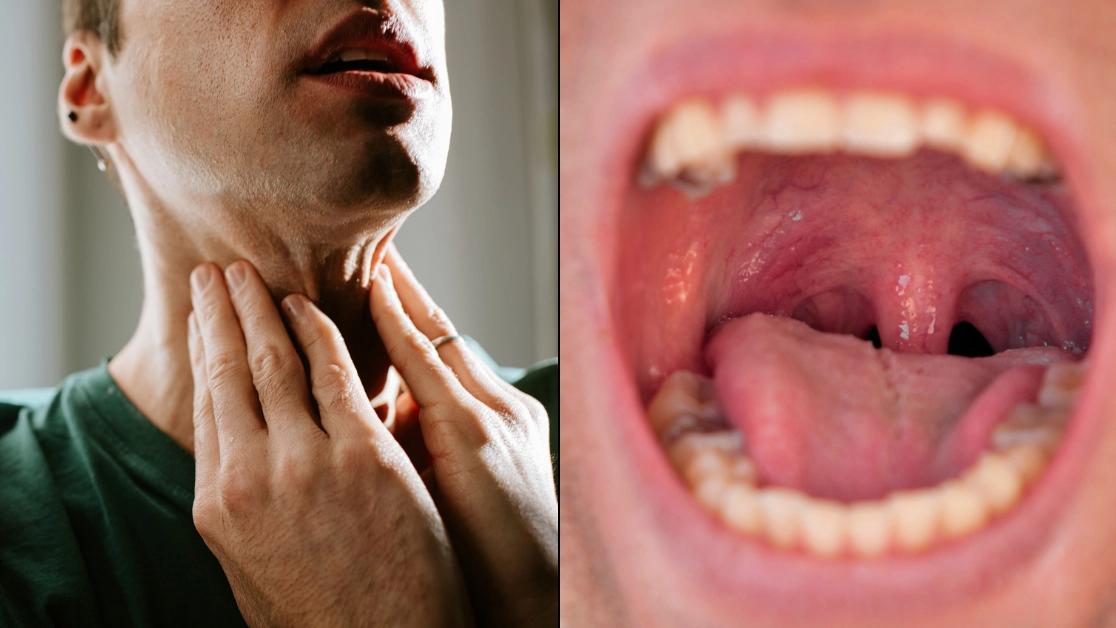 People left horrified after finding out your tonsils can grow back despite being removed