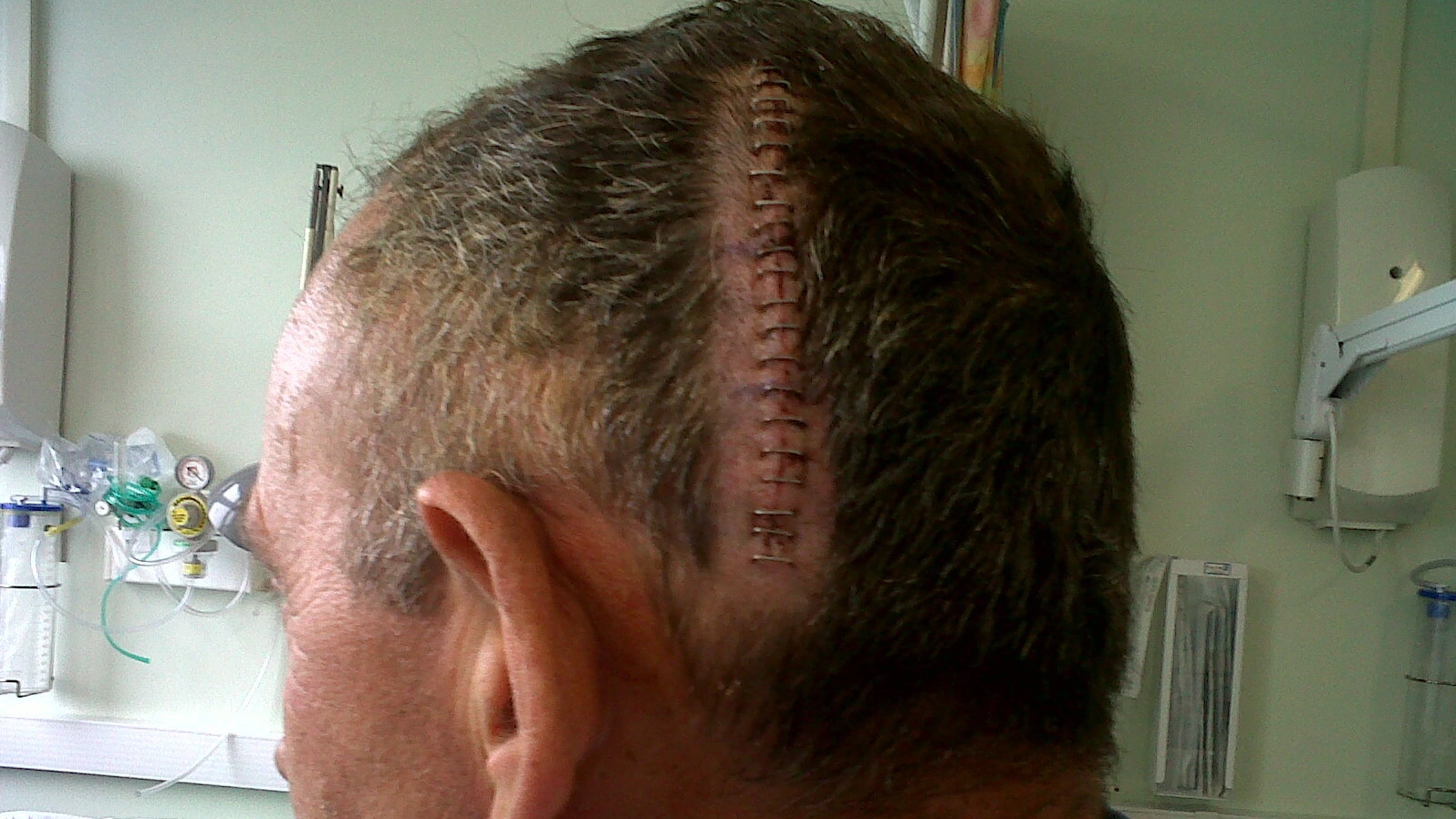 Dad diagnosed with brain cancer after symptoms were dismissed by doctor who accused him of 'faking it'