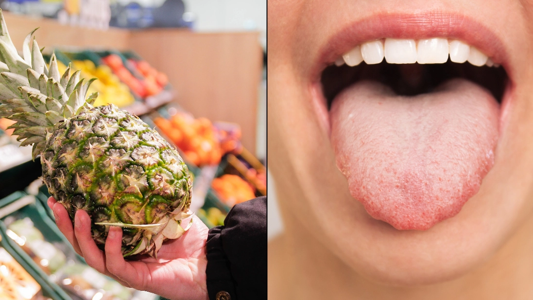 People horrified after finding out why their mouths tingle after eating pineapple