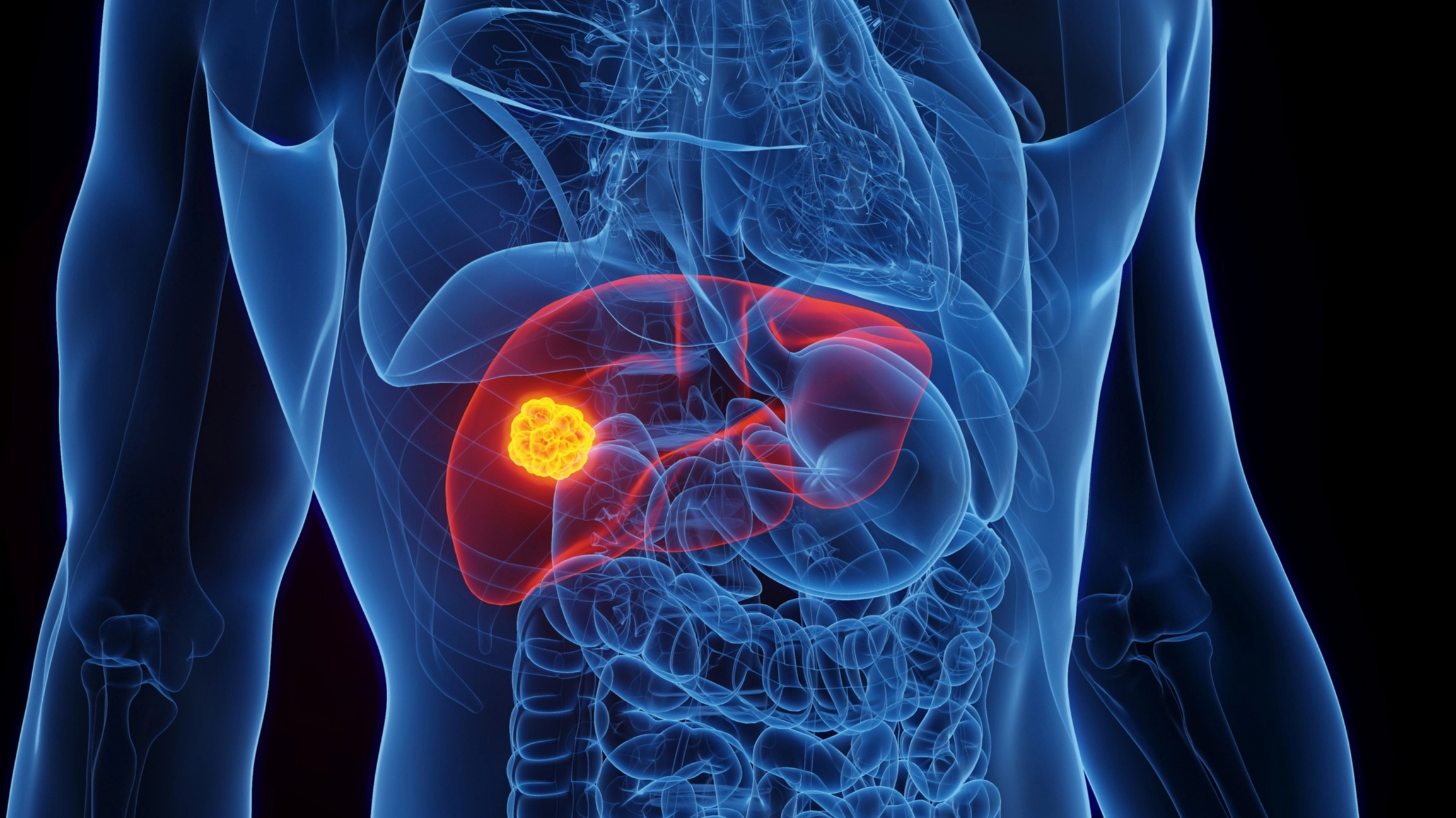 Experts issue stark warning over steroids as ‘silent killer’ cancer surges in healthy men