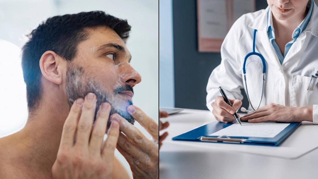 Expert says patchy beards can be sign of specific health issue
