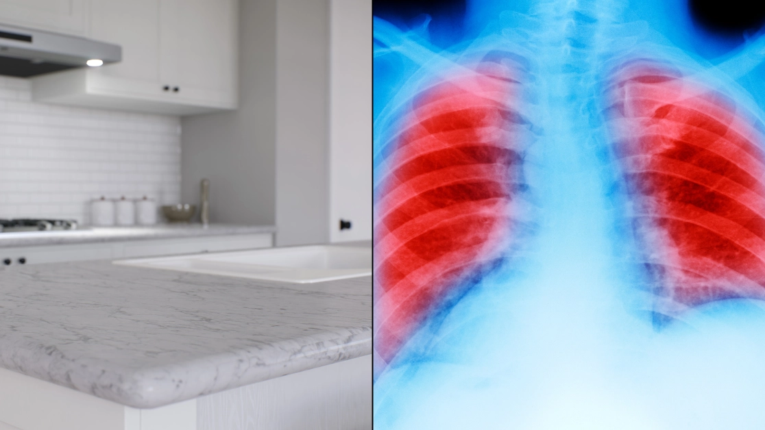 Doctor issues warning about 'increase' in killer lung disease from inhaling dust linked to kitchen worktops