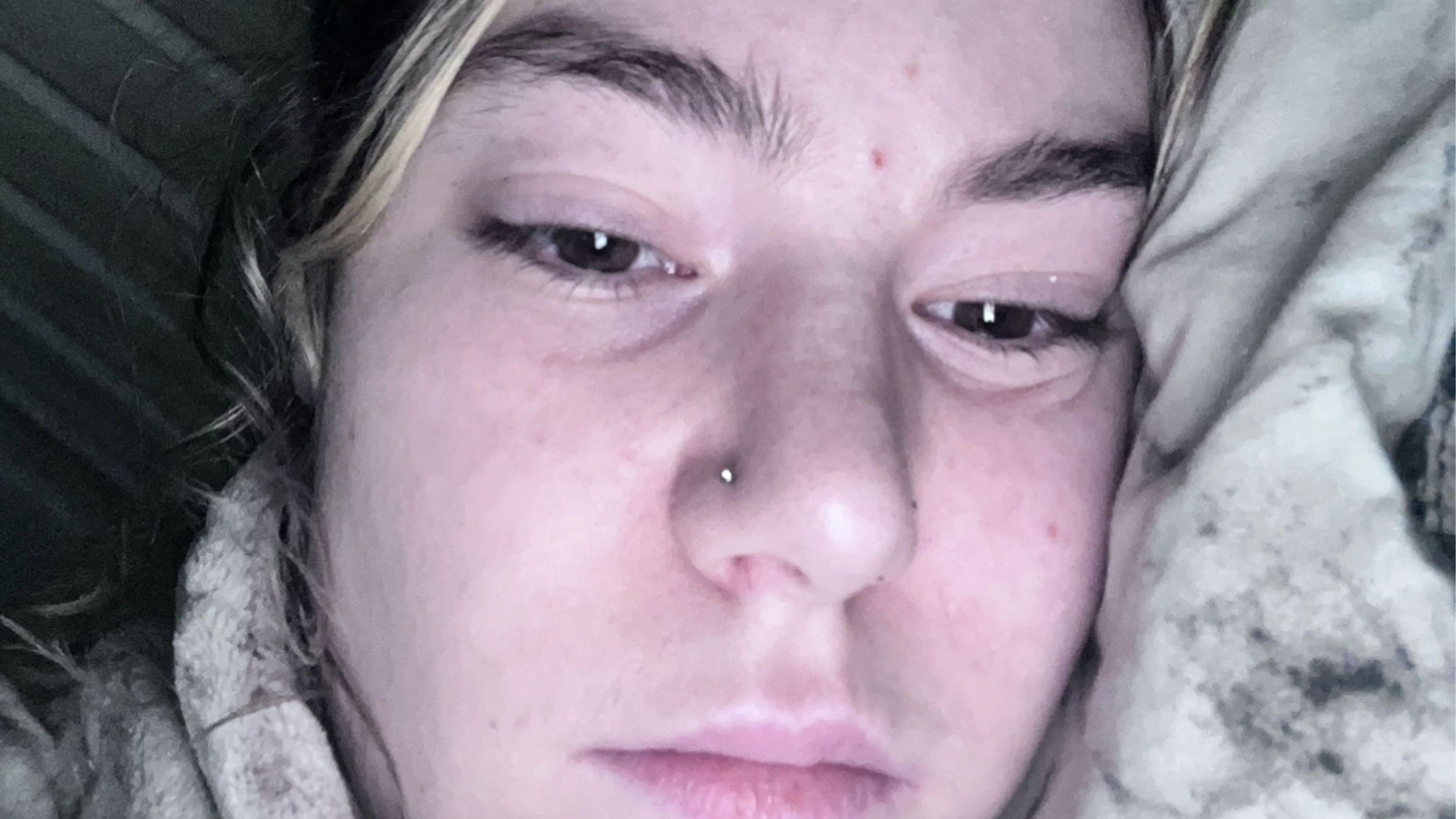Woman who snorted up to £1,000 worth of ketamine a month left using toilet 50 times a day