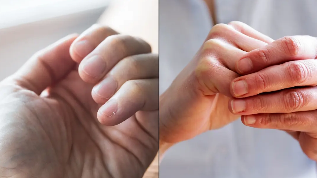Simple finger test you can do at home to see if you're suffering from serious health problem
