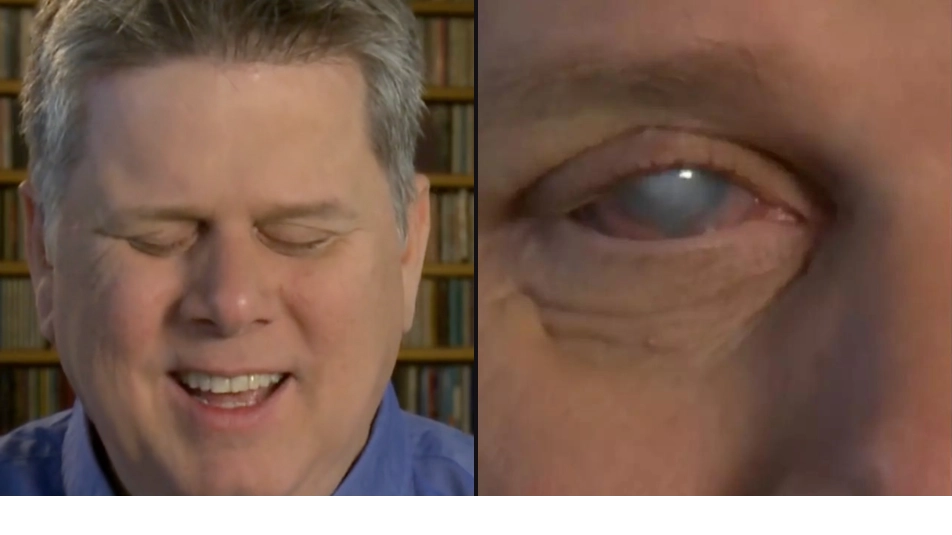 Blind man answers ‘5 hour question’ about what he can see