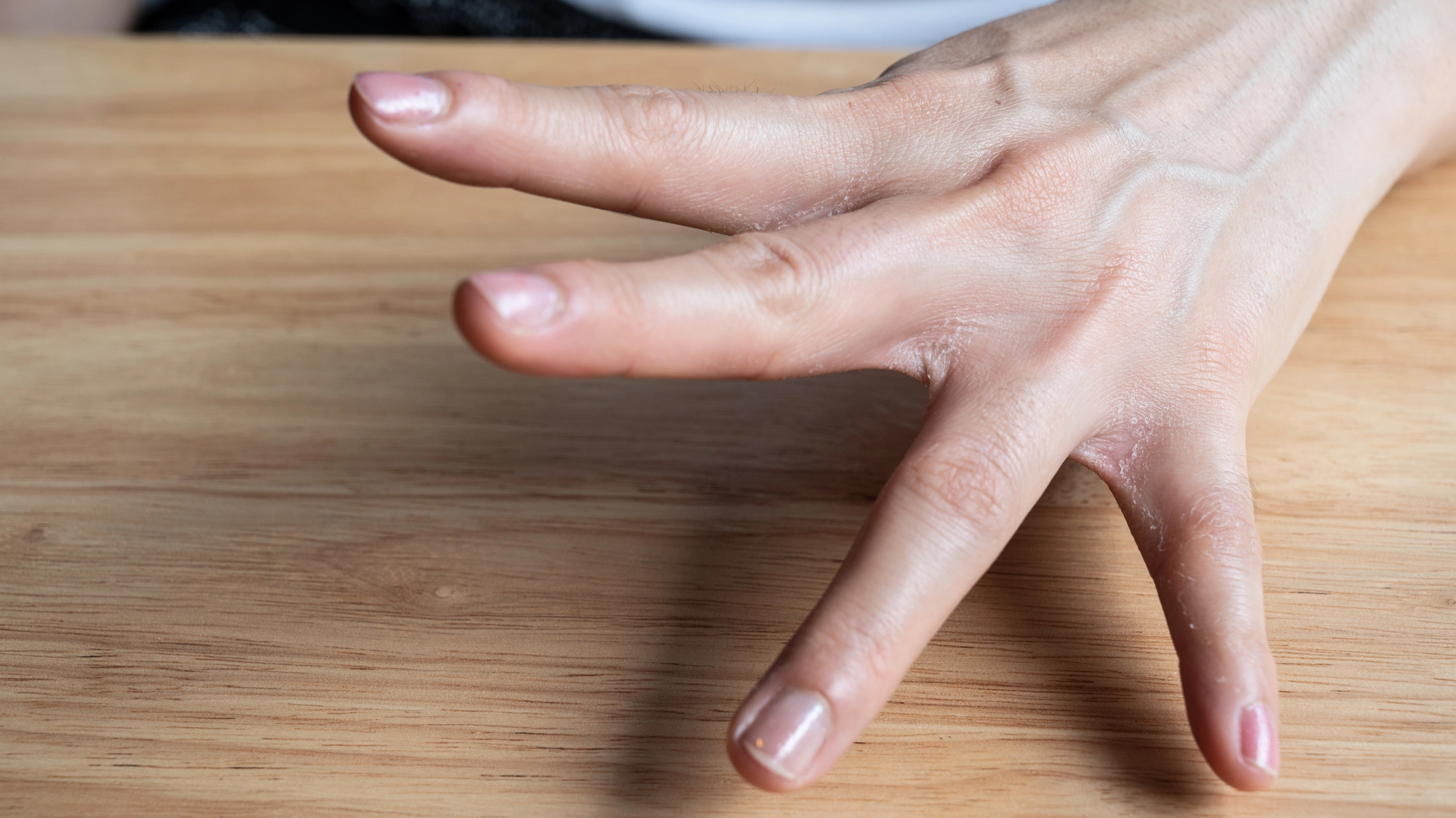 Being able to bend your fingers back a certain length could be a sign of serious health problems