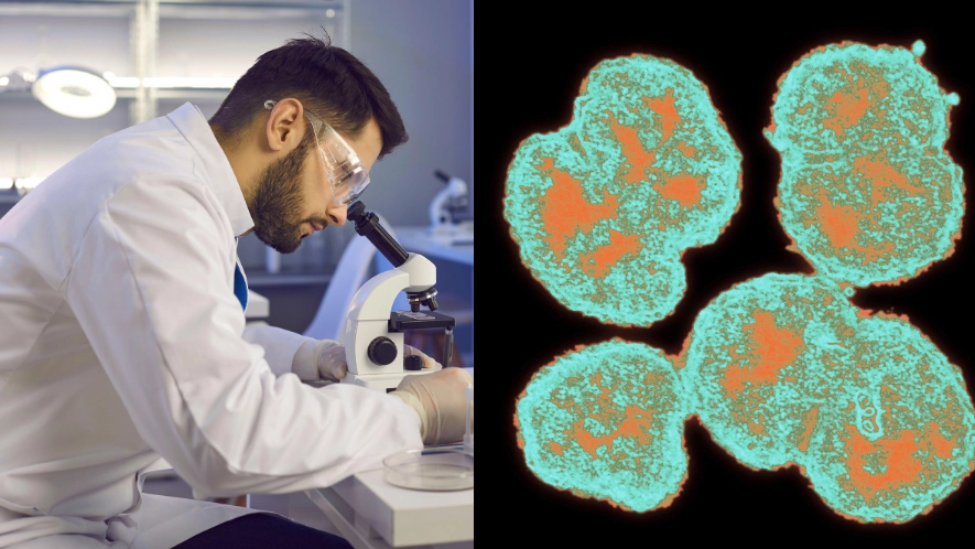 Medical experts believe gonorrhoea can be spread from kissing and urge guidelines to change