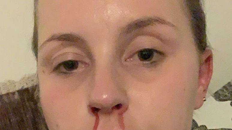 Mum who snorted £1k-a-week worth of cocaine reveals worrying effect it had on body