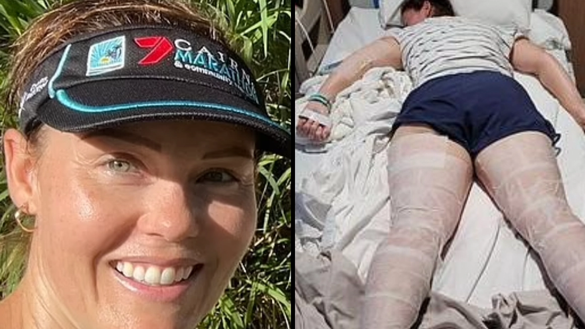 Woman who fell into 'world's most dangerous plant' is suffering 'unbearable pain'