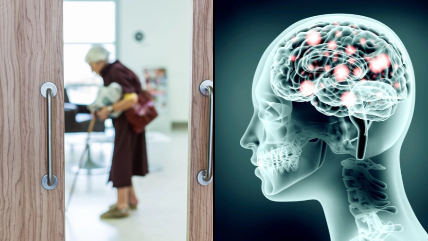 New Alzheimer's drug breakthrough being hailed as 'beginning of the end'