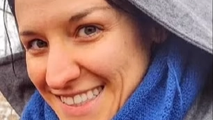Insane side by side photos of woman show alarming effect of eating too many carrots