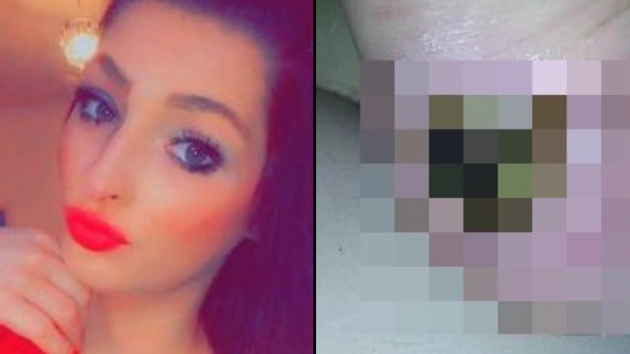 24-year-old woman issues warning after ‘simple blister’ led to her being forced to have leg amputated