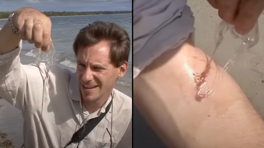 Man records moment he gets stung by 'most venomous creature on Earth' that can 'kill in minutes'