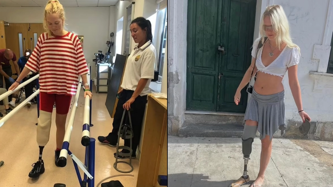 Woman who had leg amputated aged 22 after horror bus crash reveals what 'distinct voice in her head' said