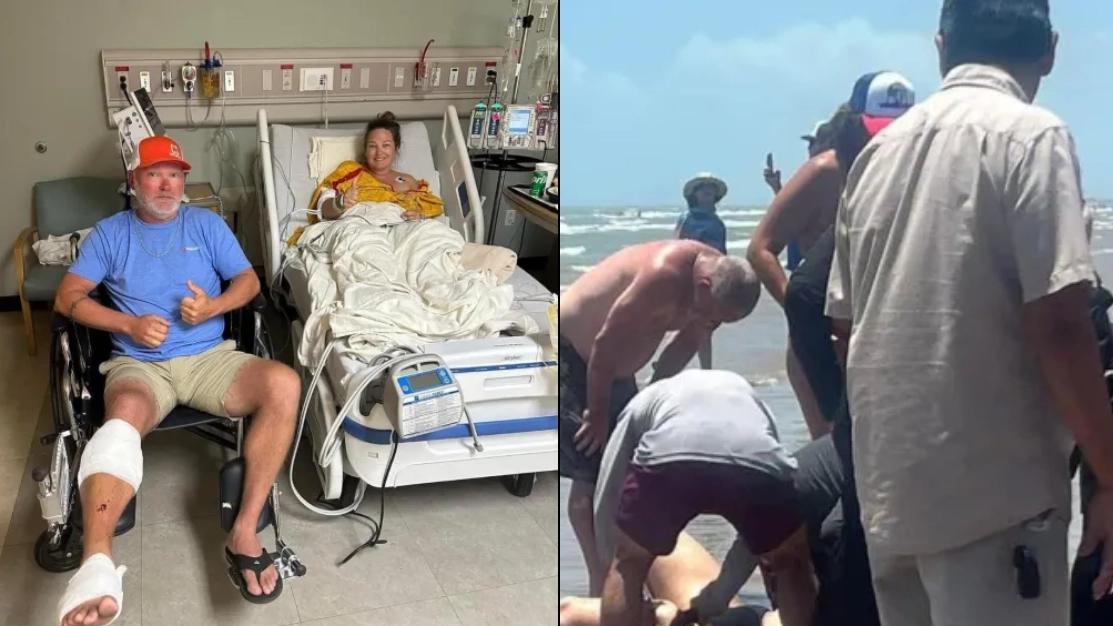 Woman has calf torn off in horrific shark attack after thinking it was 'huge fish'