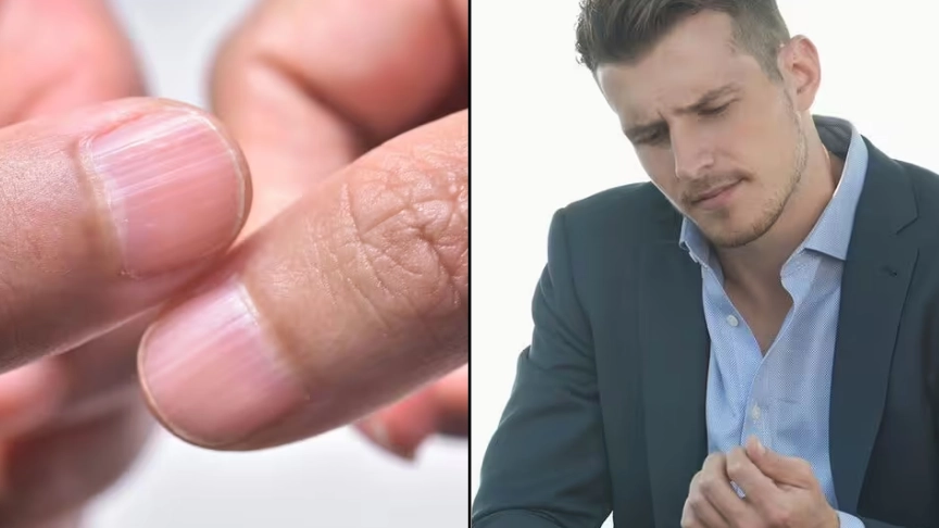 Doctor explains seven worrying health conditions people can spot just by checking their nails