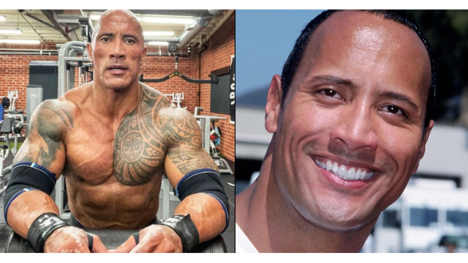 Dwayne Johnson had male breast reduction surgery to eliminate the appearance of man boobs