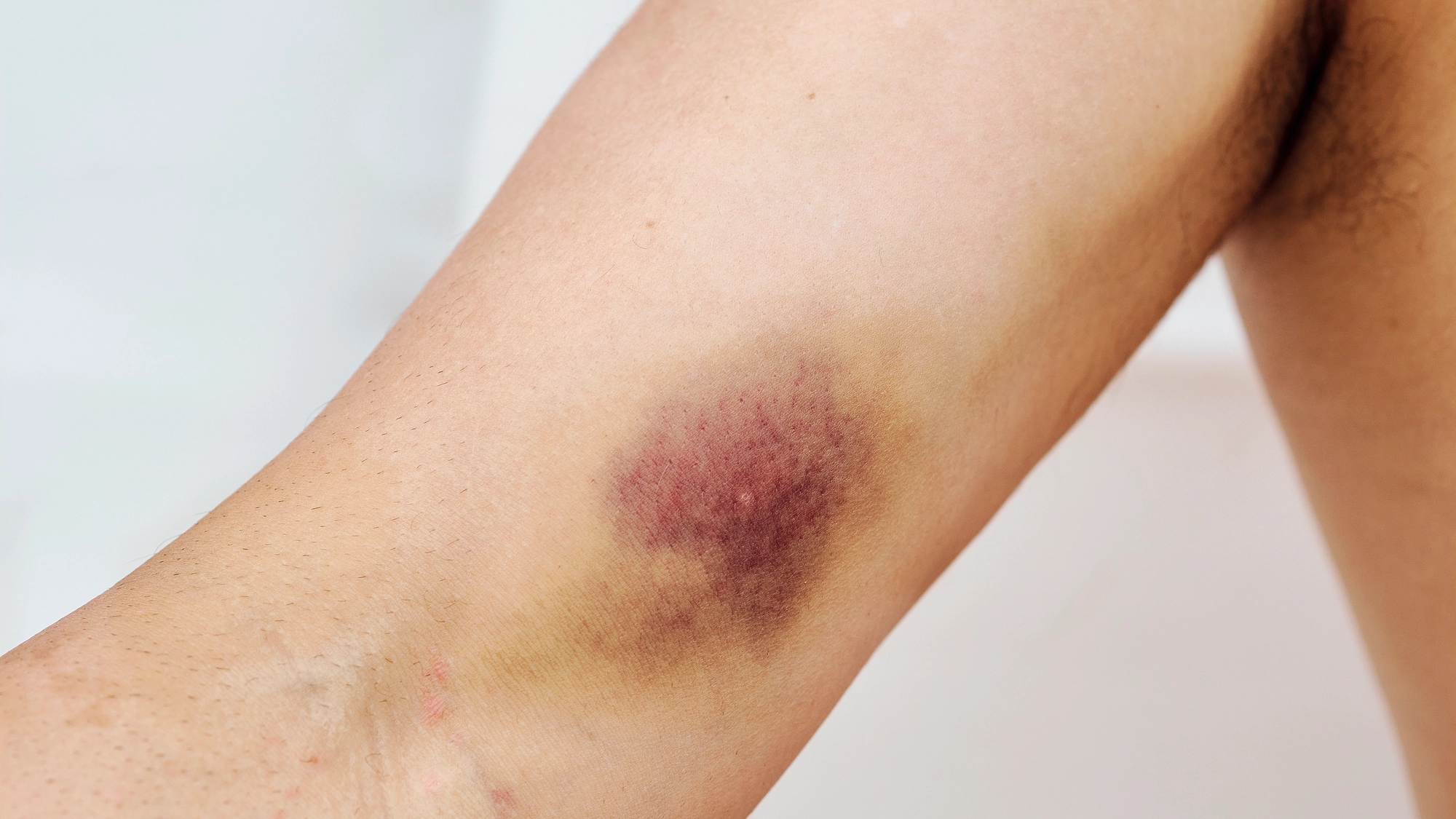 Reason behind 'red spot rash' that can appear anywhere on your body that you might not even notice