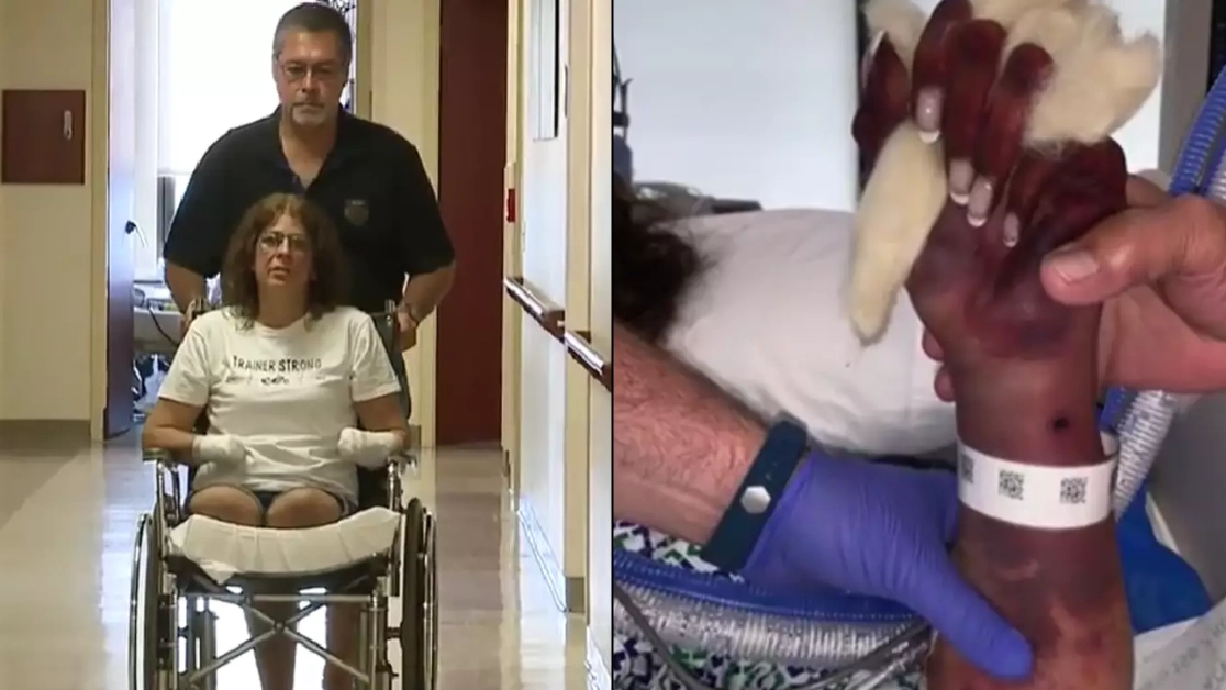 'Hardest thing' woman had to learn after 'normal' thing she did left her needing quadruple amputation