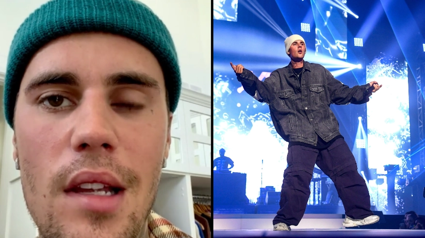 Doctors Warn Justin Bieber’s Facial Paralysis Condition Could Take Months To Heal