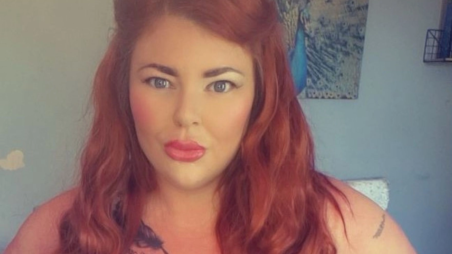 Mum who used Mounjaro for glow-up ended up with eyes 'turning yellow' and needing her gallbladder removed