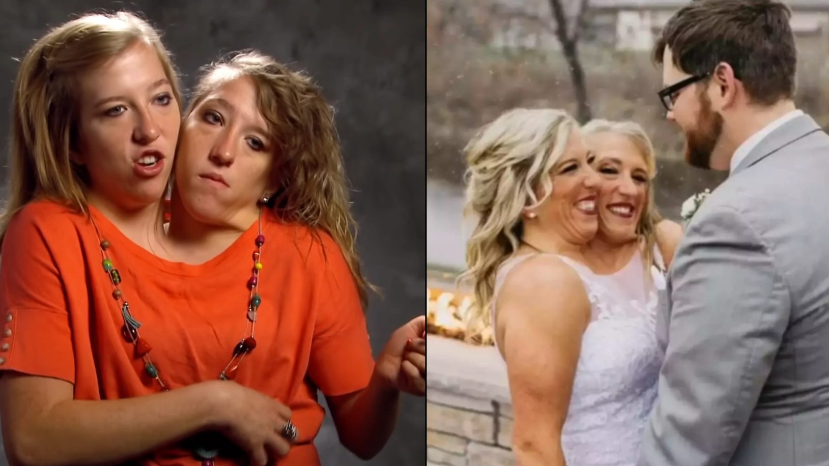 Conjoined twins Brittany and Abby explain what happens when they get sick