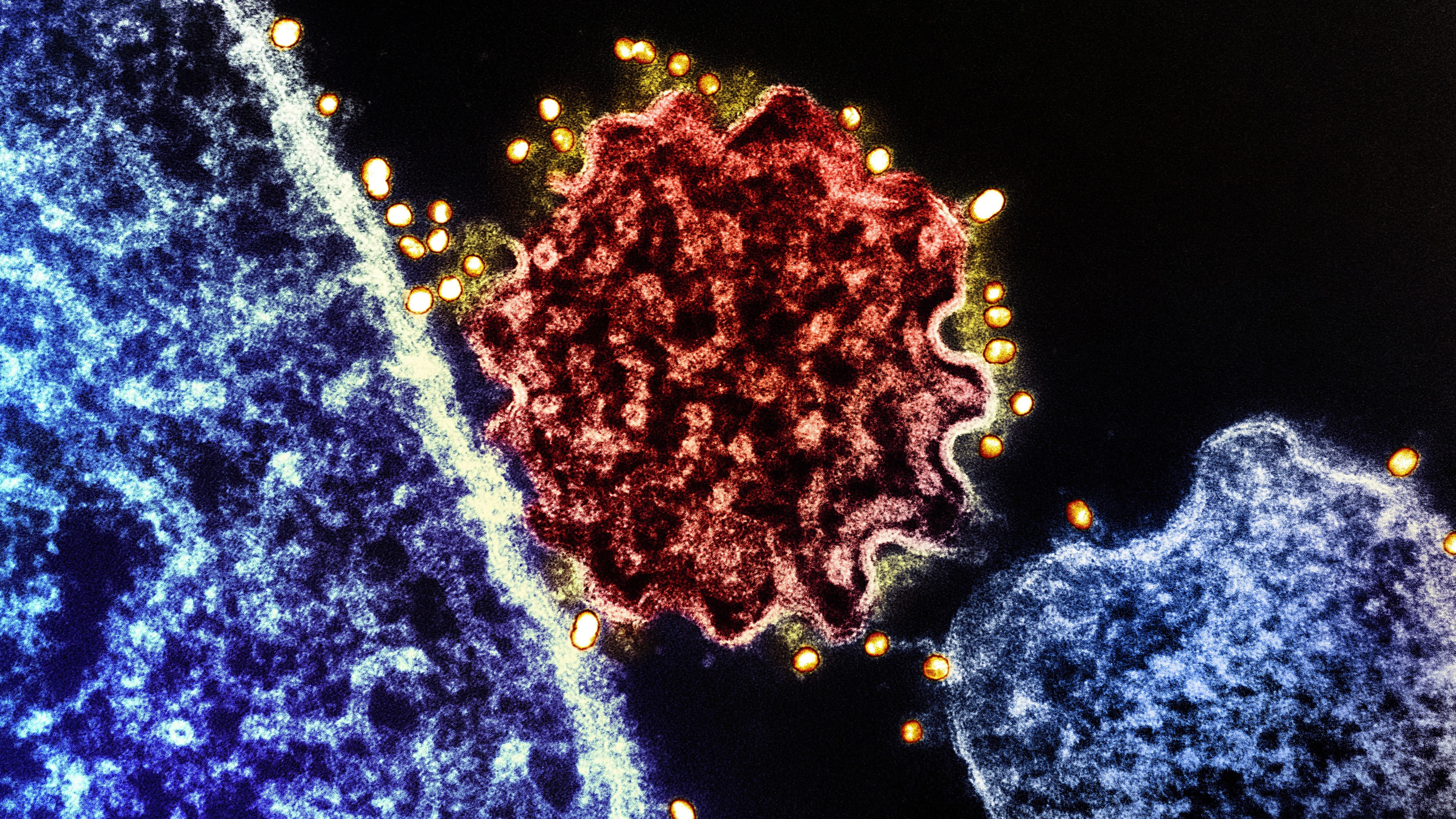 How to tell the difference between deadly Nipah virus and flu as airports introduce Covid-style measures