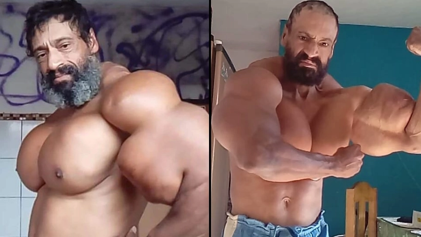 Man Who Injects Oil Into His Muscles Isn't Planning On Stopping Any Time Soon