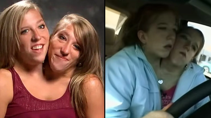 Conjoined twins Abby and Brittany Hensel answer questions everyone wants to know about their lives