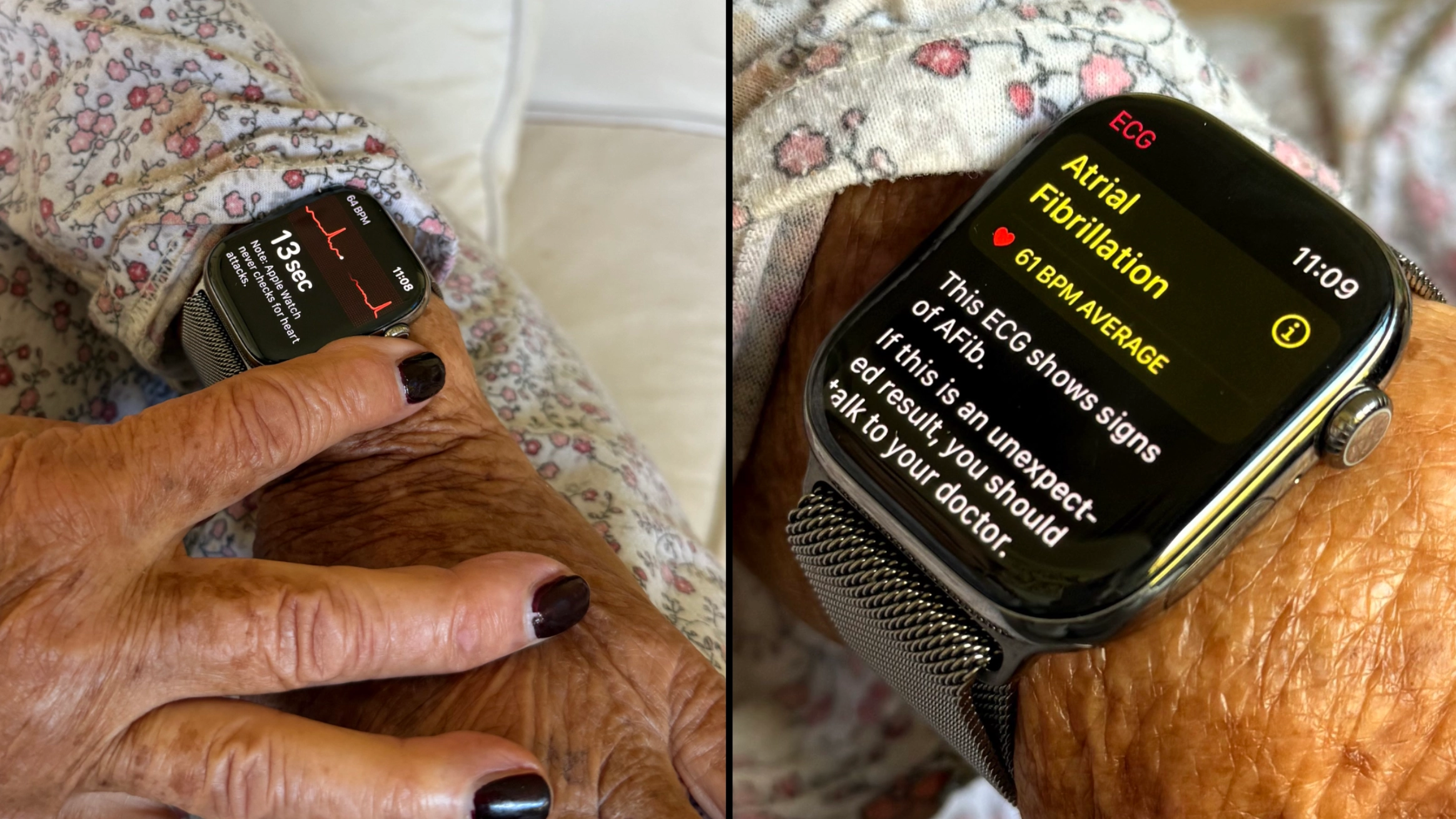 Stunned man sends grandmother to hospital after Apple Watch detected her heart problem before they noticed any symptoms