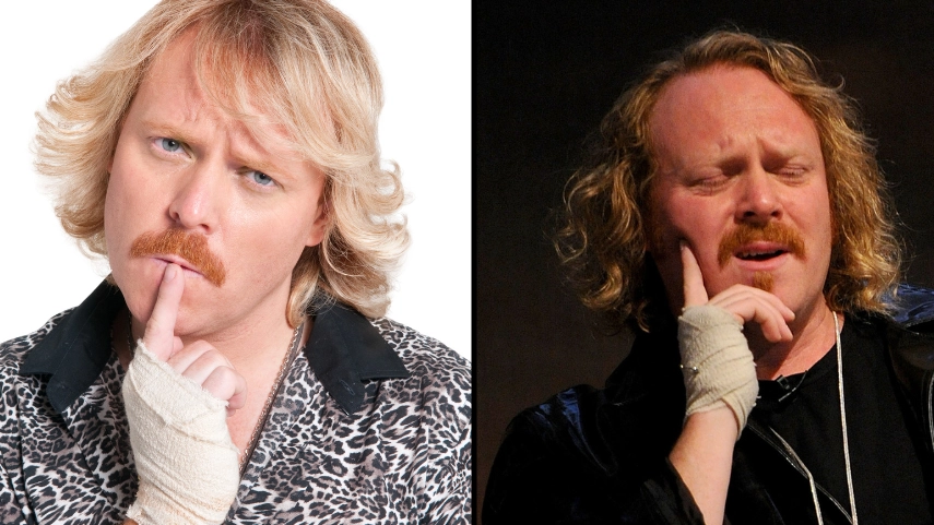 Real reason Keith Lemon always wears a bandage on his hand