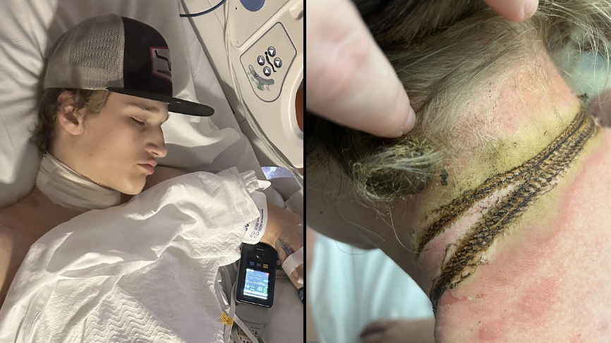 Teen almost dies in phone charger accident after chain is electrocuted into his neck