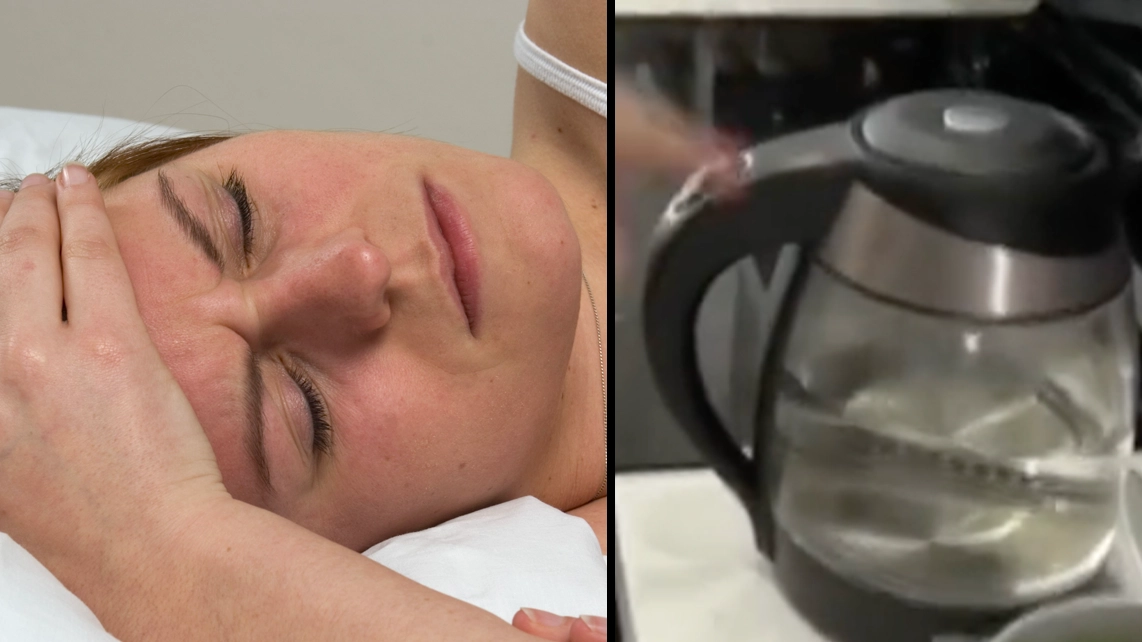 Doctor explains hot water migraine trick which will get rid of headaches and leave you with no side effects