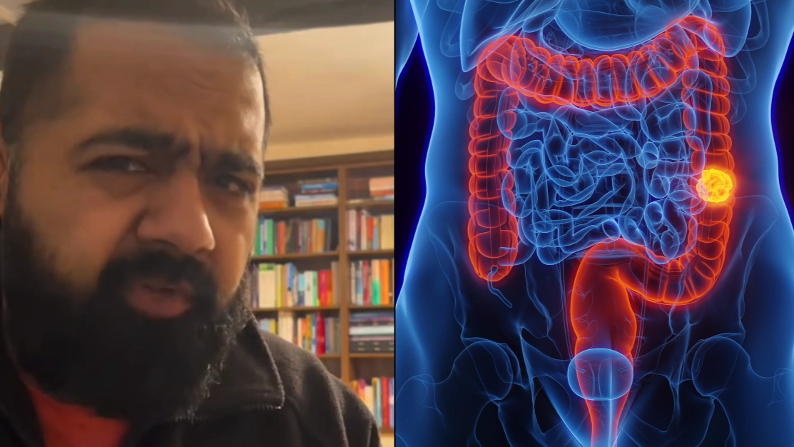 Man says doctor has 'literally saved his life' after sharing bowel cancer self-check as cases in under 50s soar