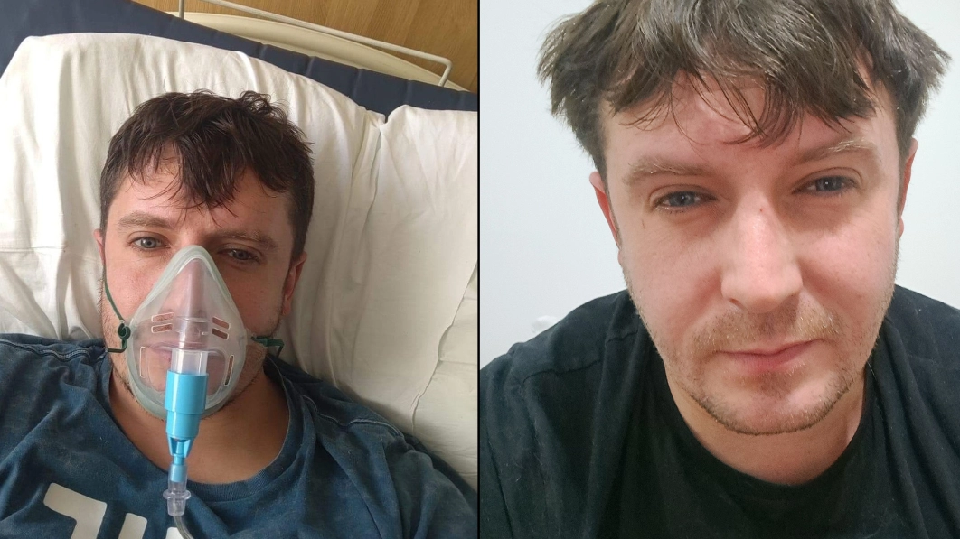 Man issues warning over household mould after he is hit by deadly fungal lung disease