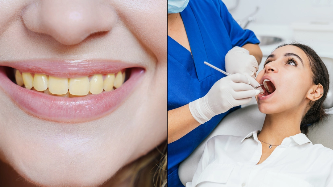 Dentist warns common method people use to whiten teeth is actually making them go more yellow