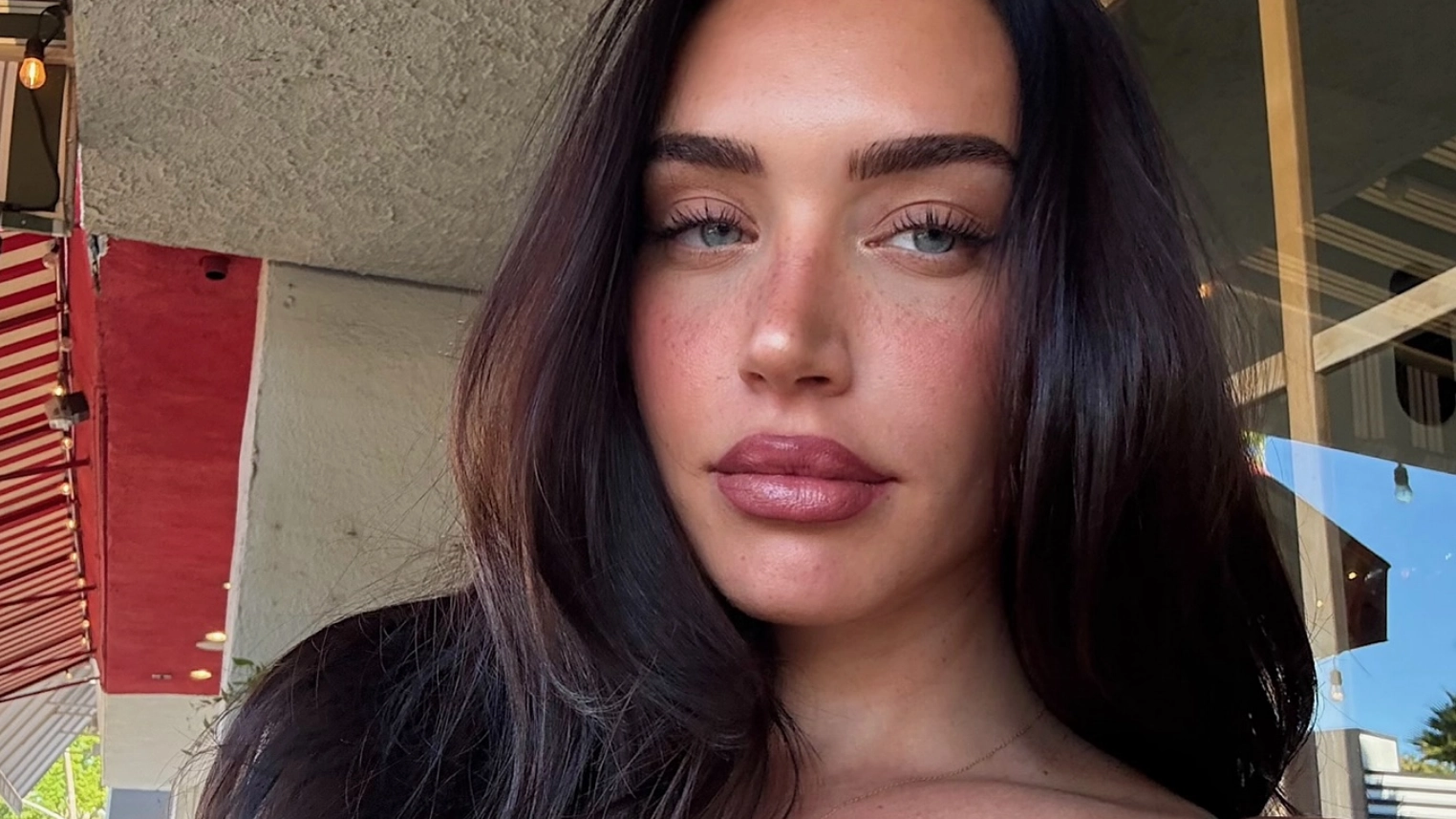 Influencer 'Stassie Baby' reveals why she got 'butt reduction surgery' after BBL at 18