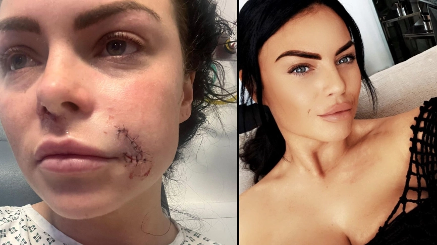 Woman left unable to speak for a week after friends dog almost 'pulled her face off'