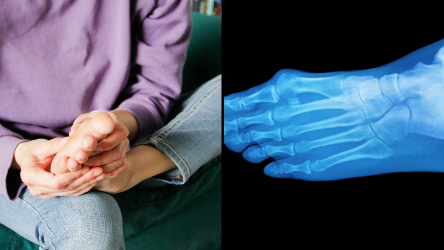 Three sinister warning signs of silent killer that can show up in your feet