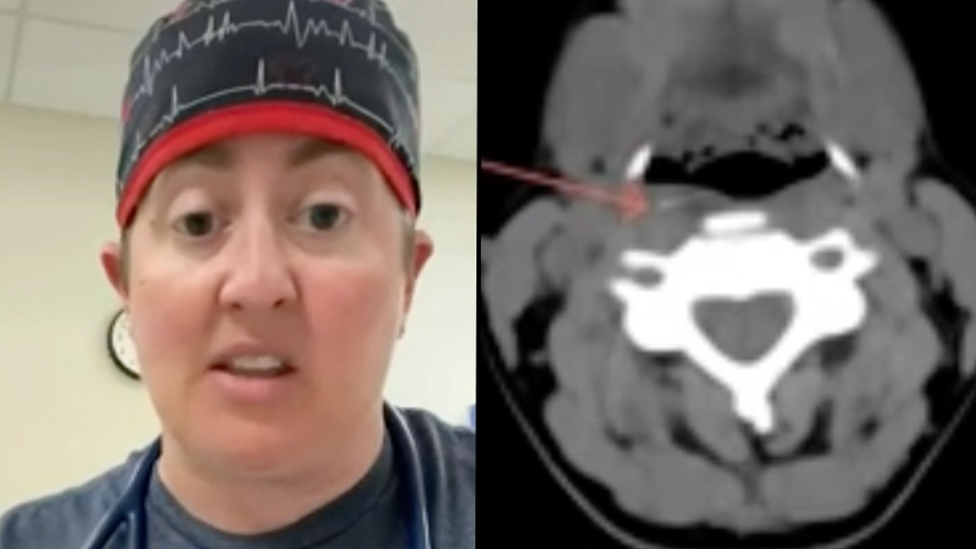Doctor makes disturbing discovery after results come back normal for 4-year-old's ear pain