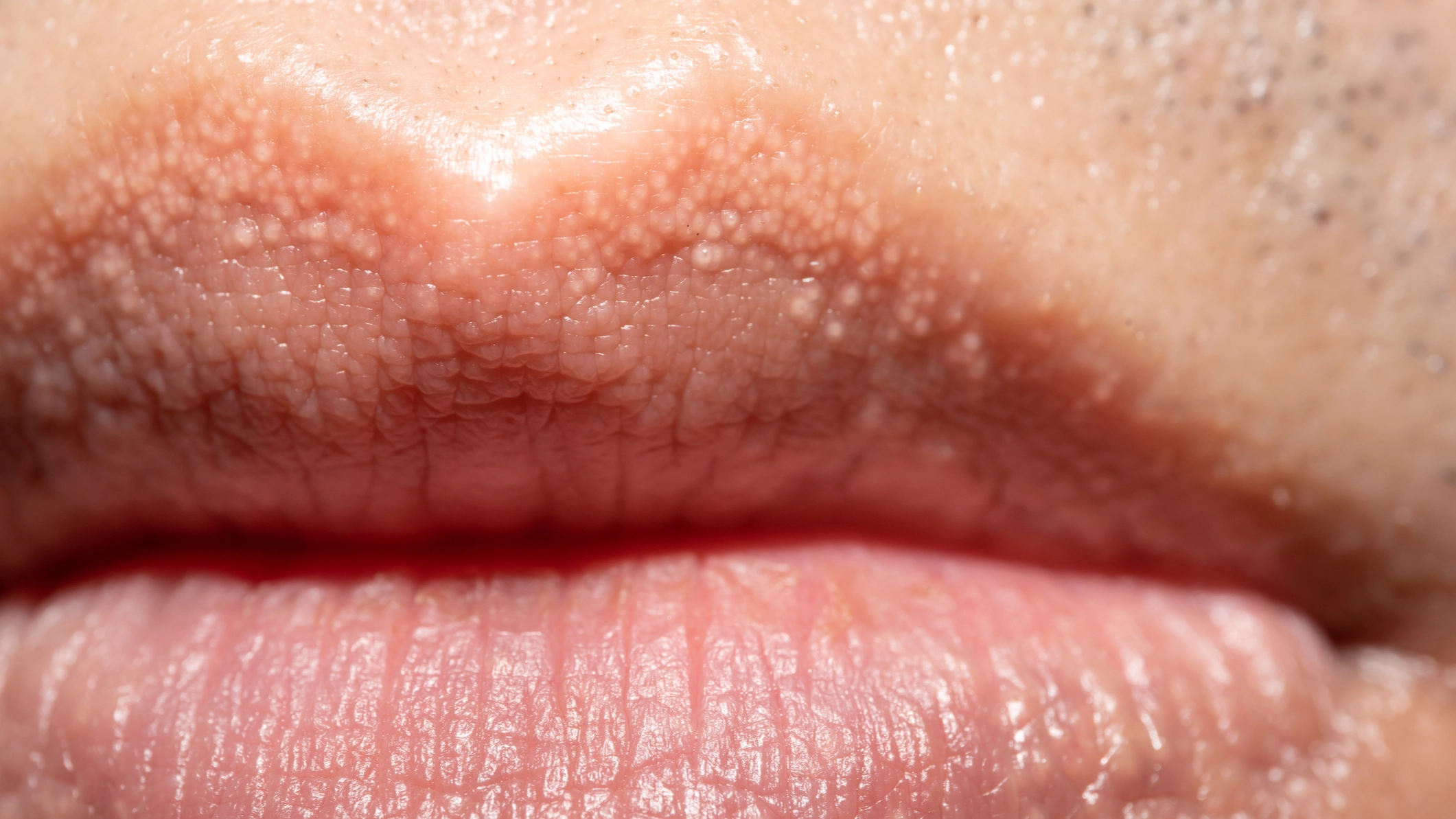 Reason behind strange white bumps you can find on your private parts