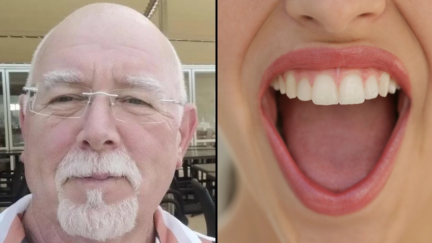 Cancer survivor says people should ‘seek help’ if they discover weird symptom in their mouth