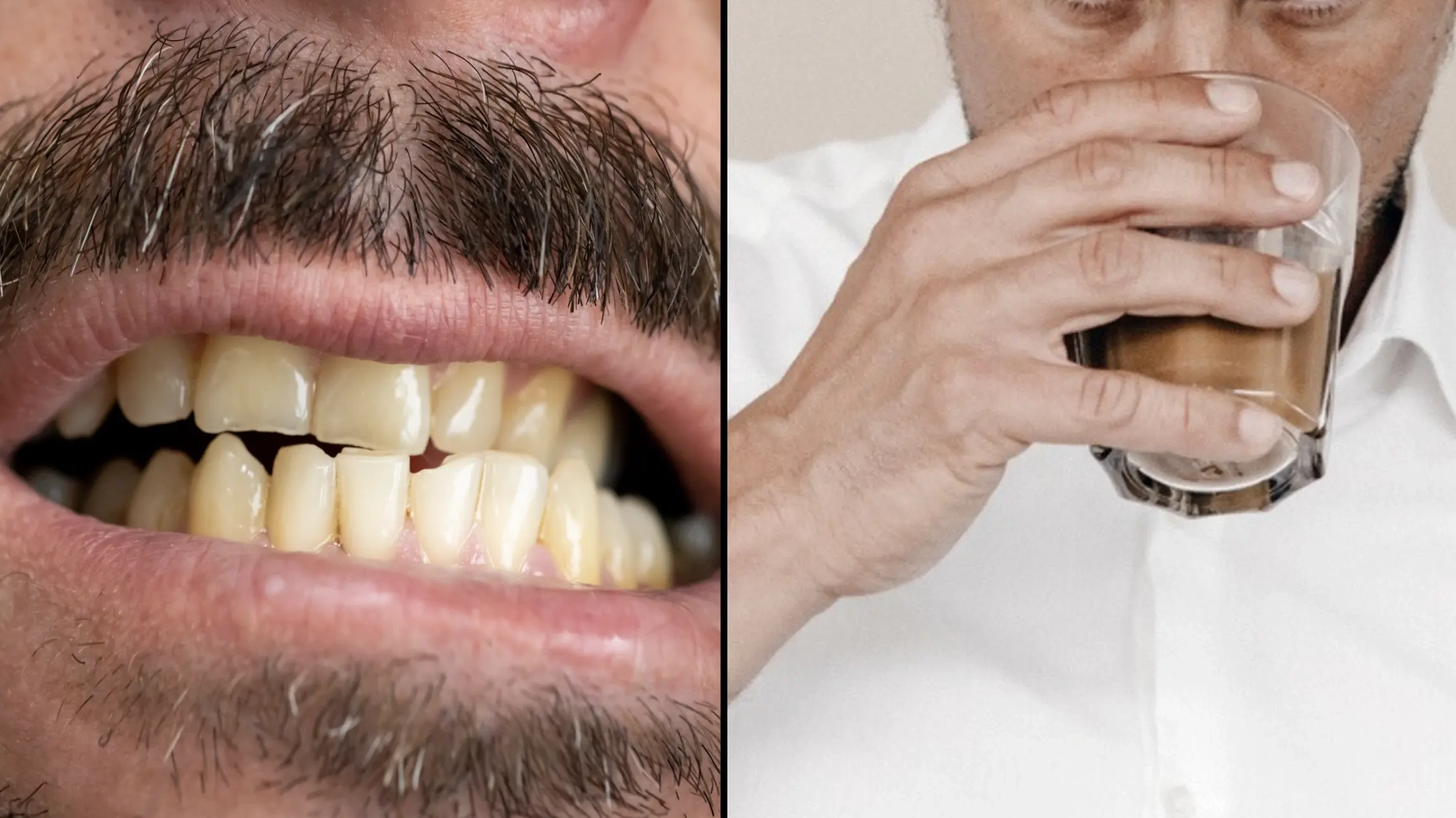 Popular drink could leave your teeth permanently yellow, expert warns