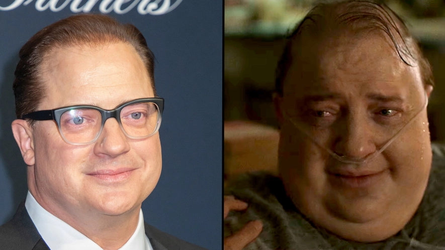 Brendan Fraser opens up on son's 'special needs' who 'lives alongside him with obesity everyday'