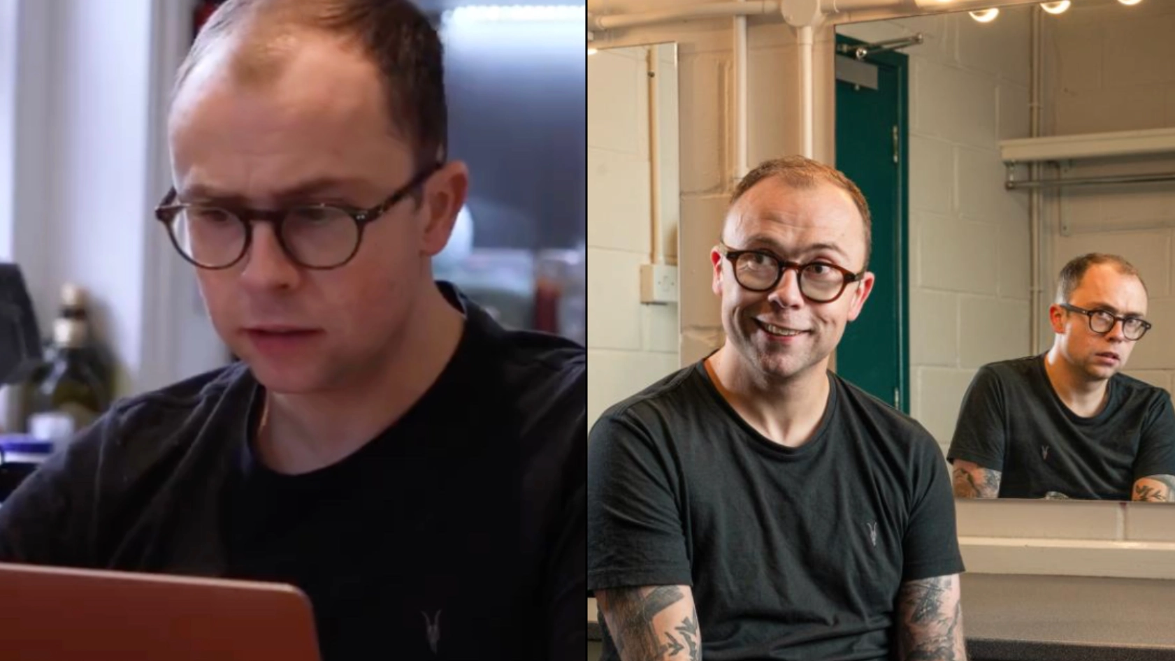 Man reveals what it’s like to live with condition that affects 2% of people in the world