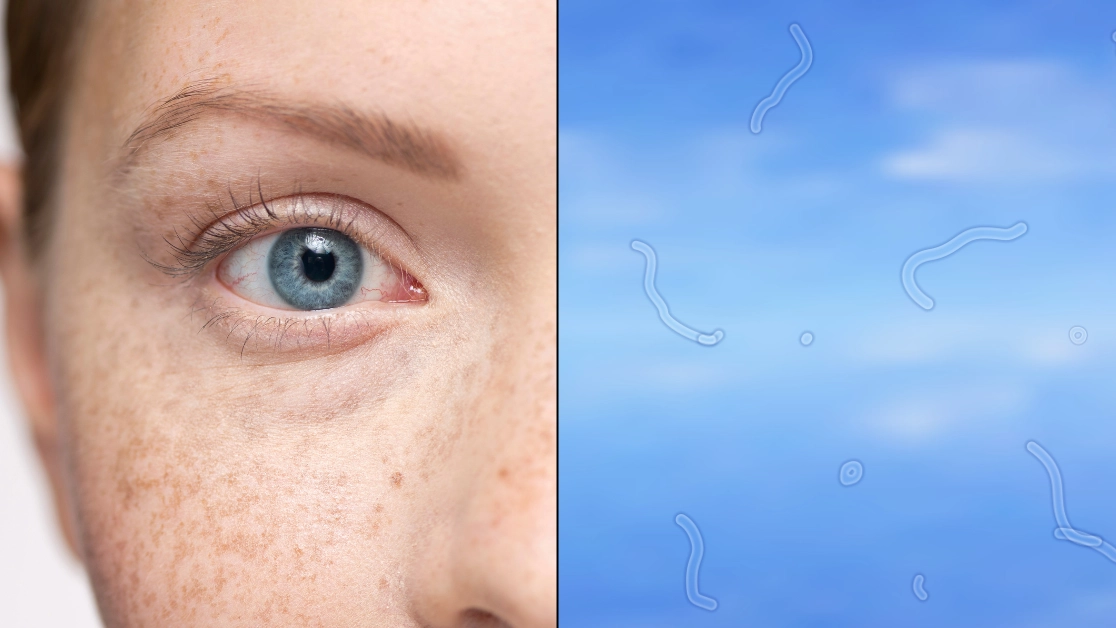 Reason why you get 'floaters' in your eyes as expert explains what you should do if you start seeing them
