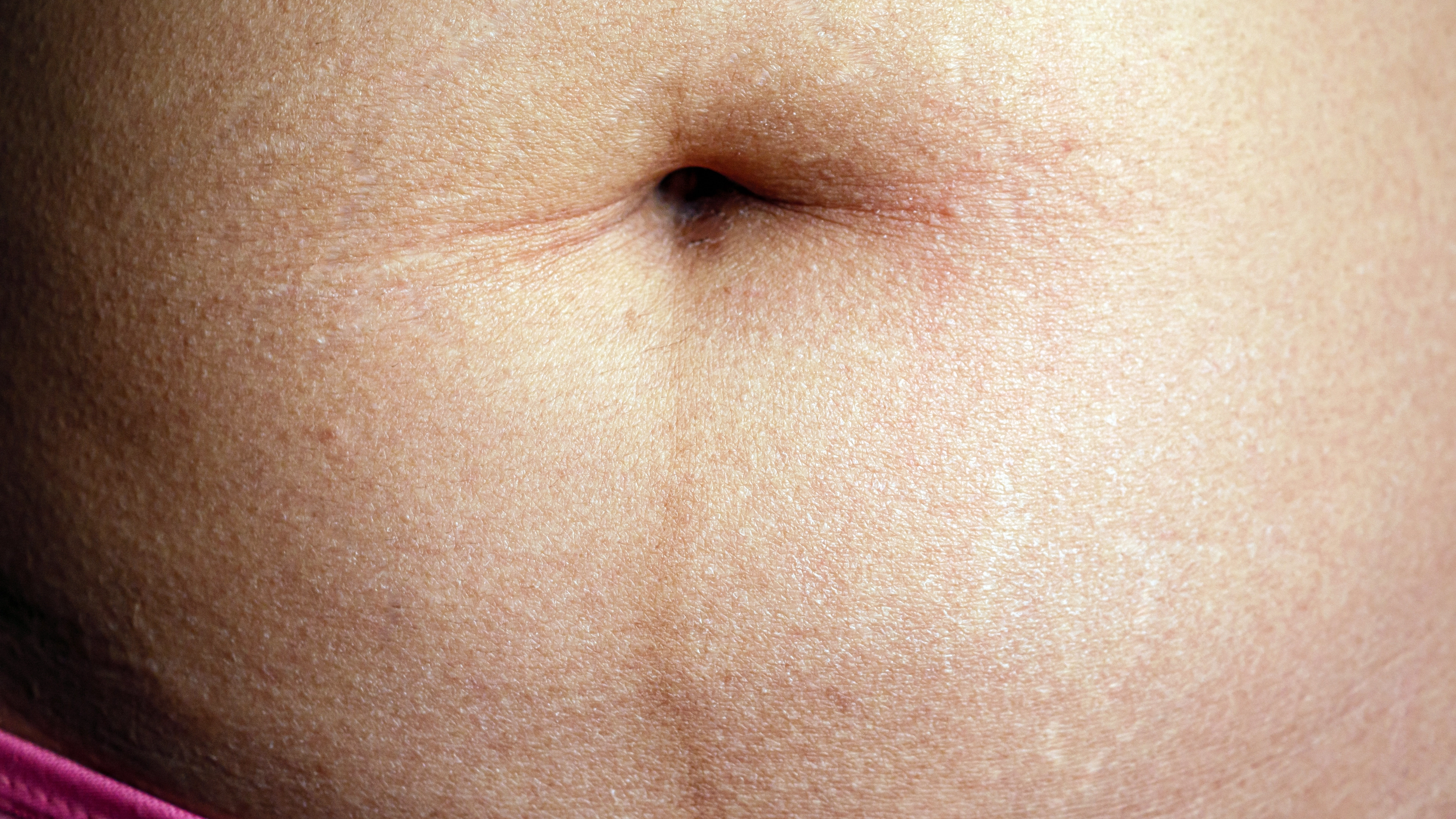 People gobsmacked after learning what faint dark line that appears on their belly actually is