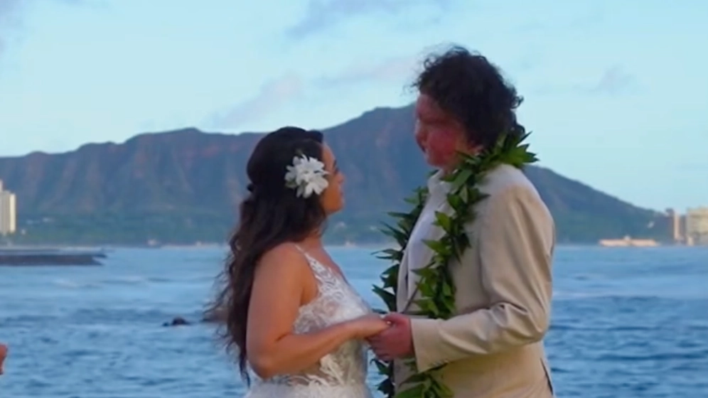 Man who had world’s first successful face and double hand transplant shares footage after getting married