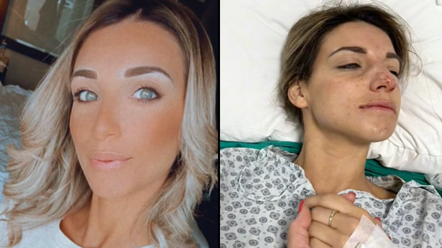 Woman Shares Horror ‘Turkey Teeth’ Experience Which Required Serious Treatment When She Returned To UK